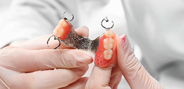 Agganciare la dentiera sulla mascella superiore