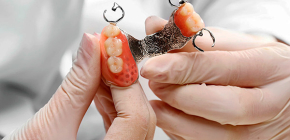 Dentadura de fechamento na mandíbula superior: fotos e nuances de próteses