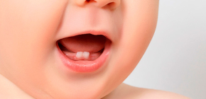 Informazioni sul morso di latte (temporaneo), nonché sulla dentizione e il cambio dei denti nei bambini