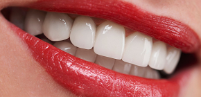 Esiste un impianto dentale non chirurgico senza incisione gengivale?