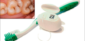 Métodos eficazes para a prevenção de cárie dentária