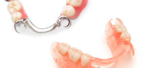 Próteses removíveis com ausência parcial de dentes: quais são melhores?