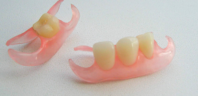 Dentaduras de borboletas e nuances importantes de próteses com sua ajuda