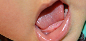 Come aiutare un bambino a tagliarsi i denti