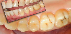 Cosa devo fare se mi fa male il dente? ..
