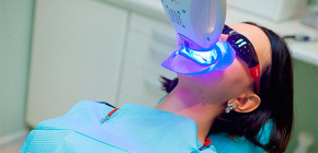 Tecnologia de clareamento dos dentes, bem como suas vantagens e desvantagens