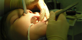 Estrazione di denti mediante anestesia 