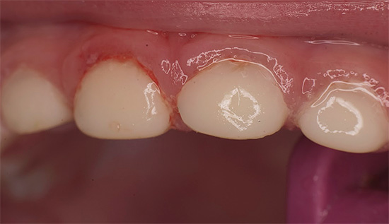E sembra il risultato finale del dentista