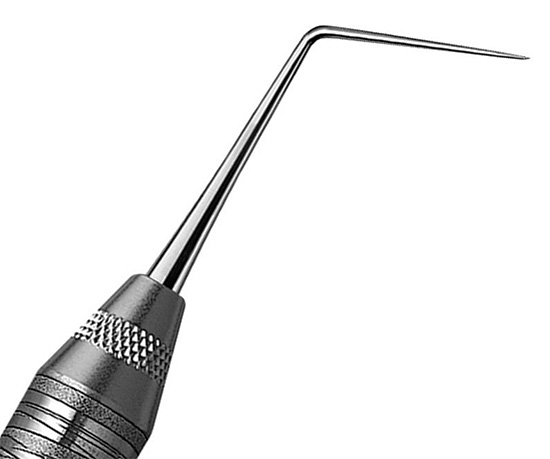 Una sonda dentale non è sempre in grado di aiutare a diagnosticare la carie delle fessure.
