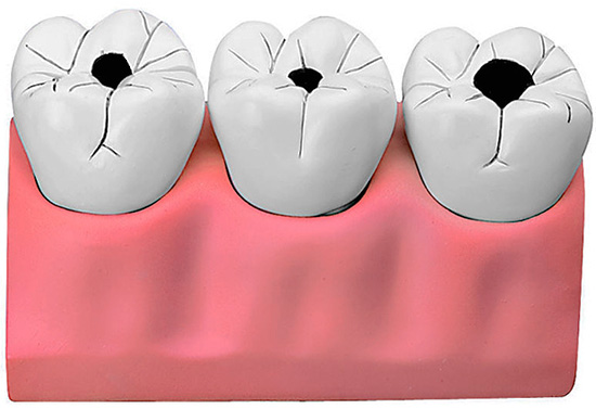 Se você costuma sonhar com problemas com os dentes, é possível que na vida real a saúde deles não esteja boa.