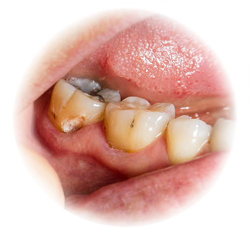 De acordo com a maioria dos livros de sonhos, a imagem dos dentes doentes geralmente não é um bom presságio.
