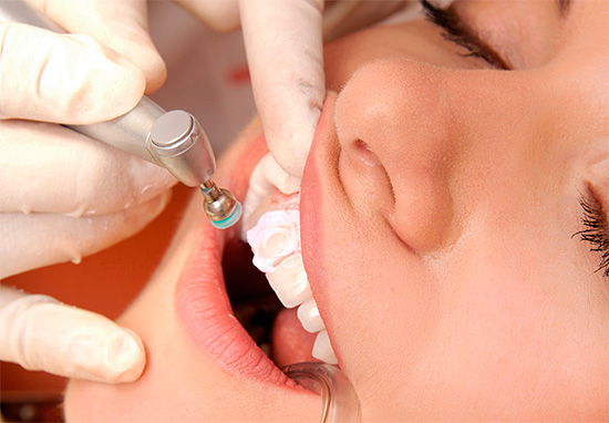 Una procedura molto utile per la protezione contro la carie è una procedura di igiene professionale, quando la placca e i depositi minerali vengono rimossi dai denti.