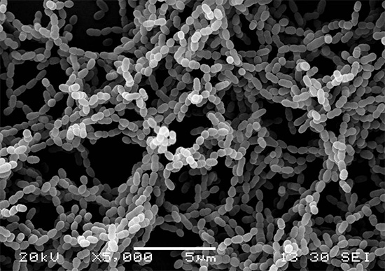 Colonie di carie Streptococcus mutans che causano carie