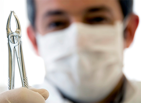 Em alguns casos, a cárie profunda sob a gengiva leva à necessidade de extração dentária.