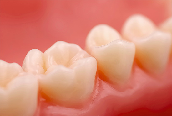 Mesmo que os dentes pareçam completamente saudáveis, é possível que ocorra um processo de cárie sob as gengivas, por isso é importante visitar o dentista regularmente.