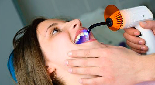 Nas clínicas modernas no tratamento de cárie profunda, os materiais de enchimento fotopolimerizados são mais frequentemente usados.