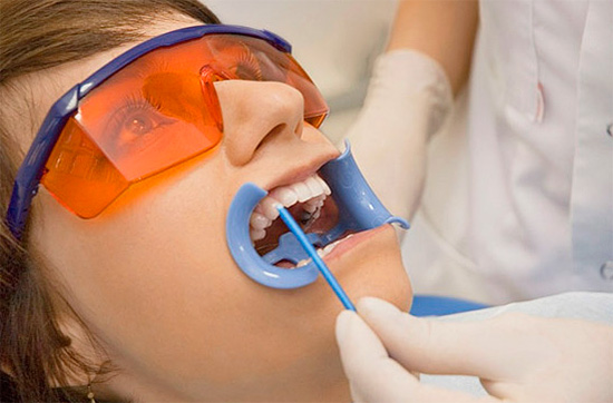 Il corso della terapia remineralizzante di solito termina con una speciale vernice al fluoro che ricopre i denti.
