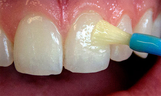Un metodo efficace per il trattamento e la prevenzione della carie è il trattamento dei denti con preparati contenenti fluoro, ad esempio vernici speciali.