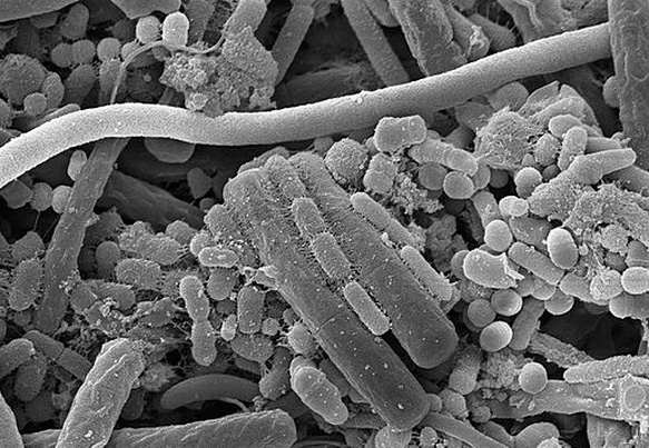 Secondo la teoria parassitaria dello sviluppo della carie dei denti di Miller, questa malattia si sviluppa a causa dell'attività vitale dei microrganismi nella placca e nella cavità orale.