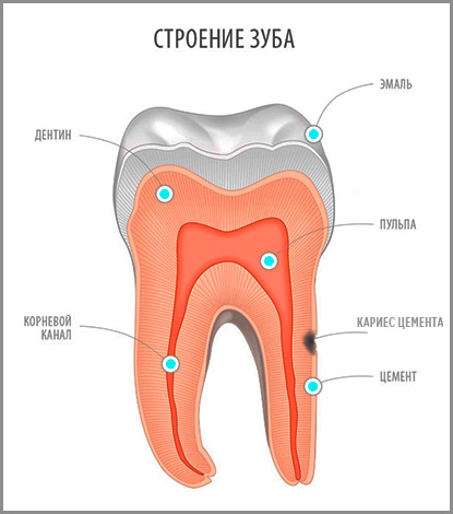 Nello studio dentistico, la carie è piuttosto rara, ma questa patologia è molto insidiosa e, se non trattata, può facilmente portare alla perdita dei denti ...