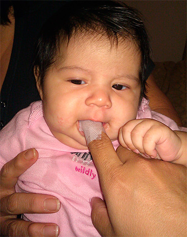I denti da latte del bambino dovrebbero essere curati sin dalla tenera età, pulendoli delicatamente con salviette speciali.