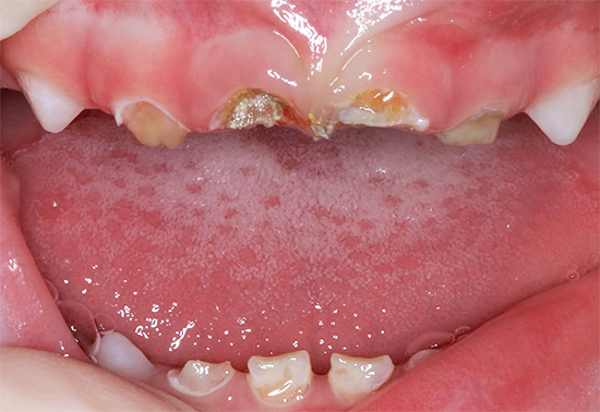 Sfortunatamente, i dentisti osservano approssimativamente tali immagini abbastanza spesso.