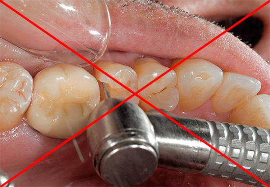 Hoje, no arsenal de dentistas, existem vários métodos que permitem tratar a cárie sem usar uma broca.