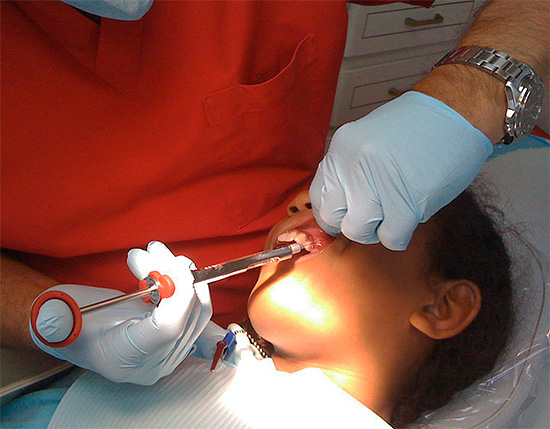 É assim que a anestesia local é realizada em odontologia