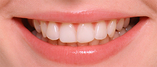 A prática mostra que medidas preventivas podem efetivamente proteger os dentes das cáries, mantendo-os saudáveis ​​por muito tempo.