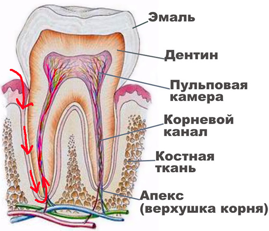 Con la pulpite retrograda, l'infezione non penetra nel dente attraverso la cavità cariata, ma attraverso l'apice della radice.