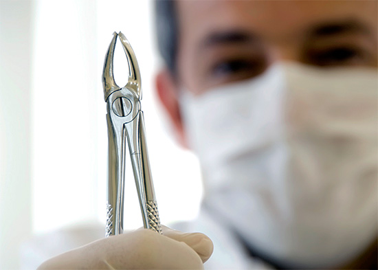 Com um simples arrancamento de um dente do siso, apenas uma pinça dental ou um elevador são usados.