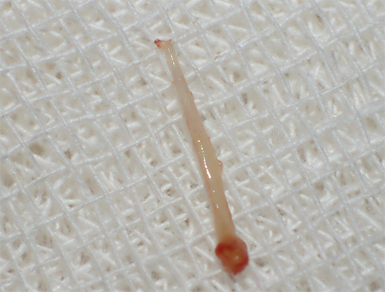Foto de polpa extraída de um dente