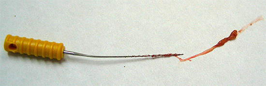 A foto mostra o nervo dentário removido.