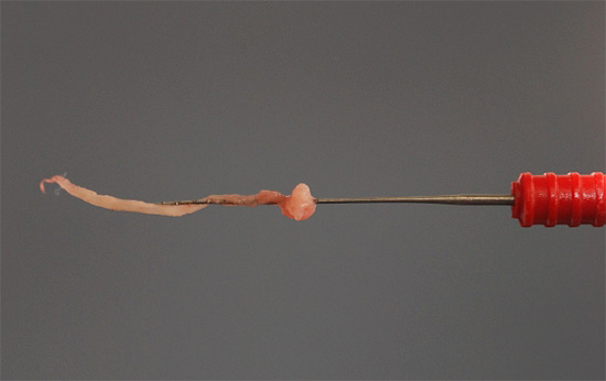 Outra fotografia de polpa extraída de um dente