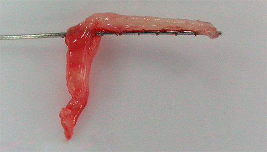 Parece polpa removida de um dente