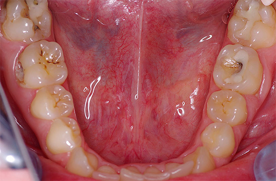 Forse i metodi di autoipnosi a volte possono alleviare il mal di denti, ma è improbabile che curino la carie ...