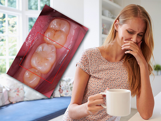 Proviamo a capire cosa dovrebbe fare una donna incinta quando si verifica un mal di denti: devo chiamare subito un dentista o posso in qualche modo sopportare il problema usando, ad esempio, gli antidolorifici ...