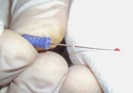 Sembra un pezzo di nervo dentale sulla punta della cartella dentale