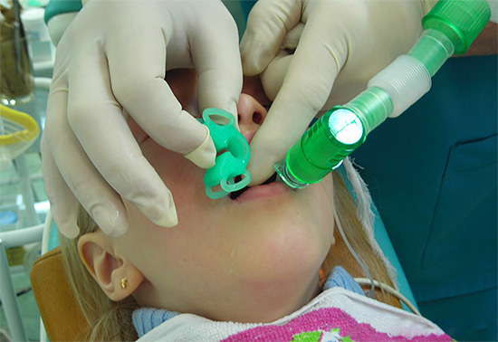 Se a criança tem muito medo de tratar os dentes, o uso de anestesia geral pode ser quase a única maneira de fornecer atendimento odontológico normal.