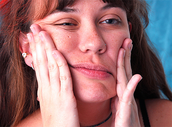 Em casos raros, quando os dentes do siso inferiores são removidos, o nervo mandibular é danificado, o que pode levar a uma perda parcial da sensibilidade em várias partes da face, lábios, queixo ...