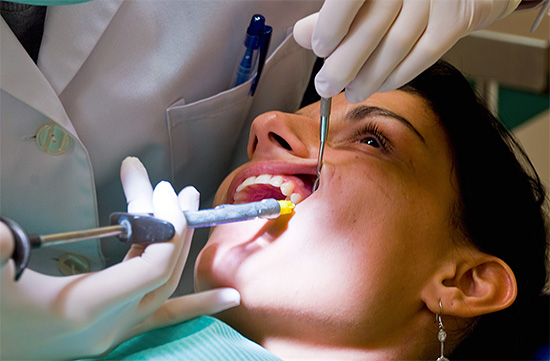 Por via de regra, ao remover dentes do siso, a anestesia local é suficiente.