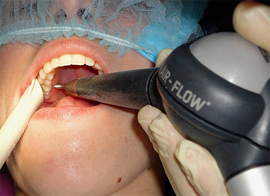 Ao clarear os dentes usando a tecnologia Air-Flow, nem sempre é possível remover completamente o tártaro.