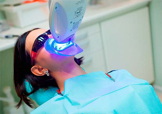 A tecnologia de clareamento dos dentes envolve a ativação de um gel clareador com a ajuda de uma lâmpada especial (por exemplo, ultravioleta).