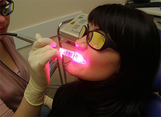 O clareamento dental a laser é inerentemente químico, e o laser é usado apenas como ativador de compostos de peróxido.