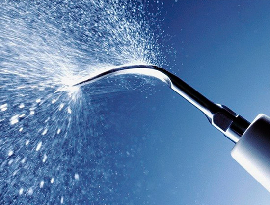 É fornecida água à ponta do aparelho de ultrassom para resfriar o dente e remover melhor os depósitos.