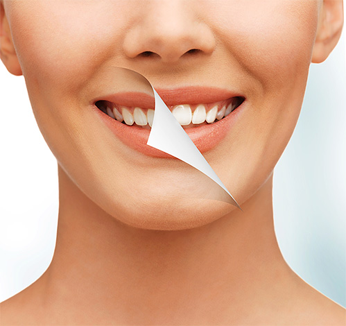 Como clarear dentes com segurança, com efeitos nocivos mínimos no esmalte e, em geral, é possível - vamos tentar entender esse tópico com mais detalhes ...