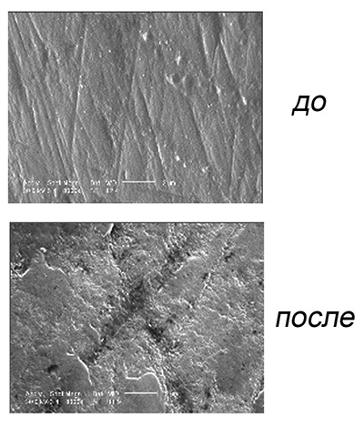 Fotografias da superfície do esmalte dos dentes sob um microscópio antes e após o clareamento químico.