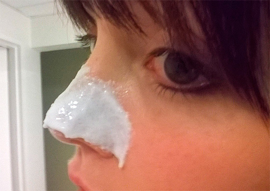 O uso de creme dental no combate à acne pode ser atribuído aos métodos da medicina tradicional, que, como você sabe, estão longe de ser sempre eficazes.
