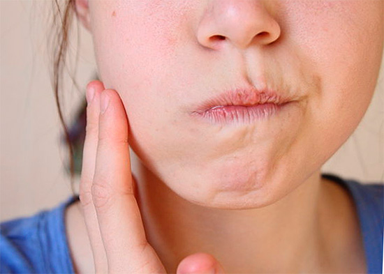 Com a lavagem da boca direita, você pode realmente se livrar da dor de dente de maneira eficaz, mas uma abordagem competente é importante aqui ...