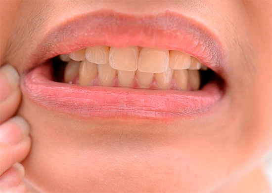 Existem muitas maneiras de aliviar a dor de dente em casa, mas nem todas são igualmente eficazes e seguras ...